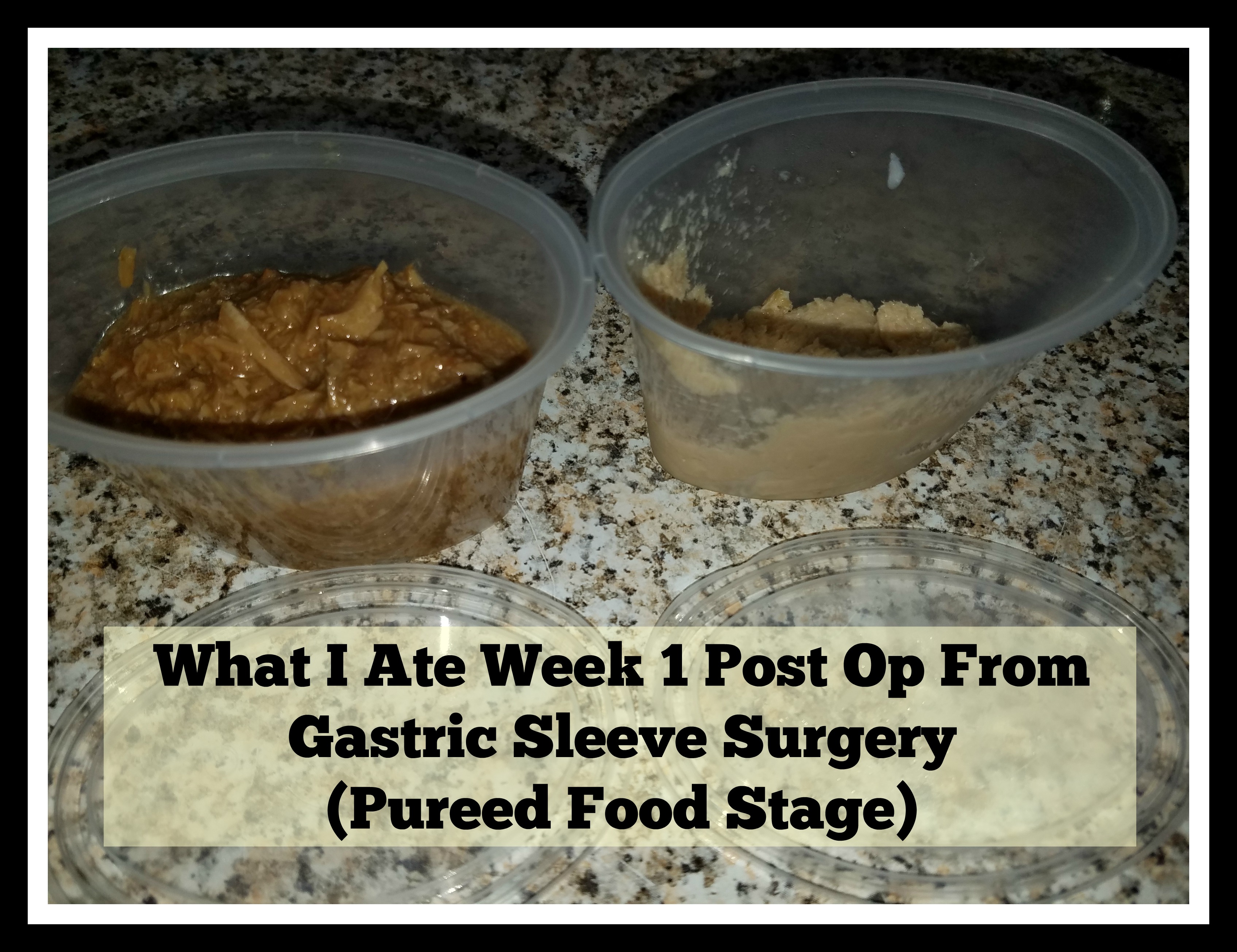 What I Ate and Drank Week 1 and 2 Post Op From Gastric Sleeve Surgery